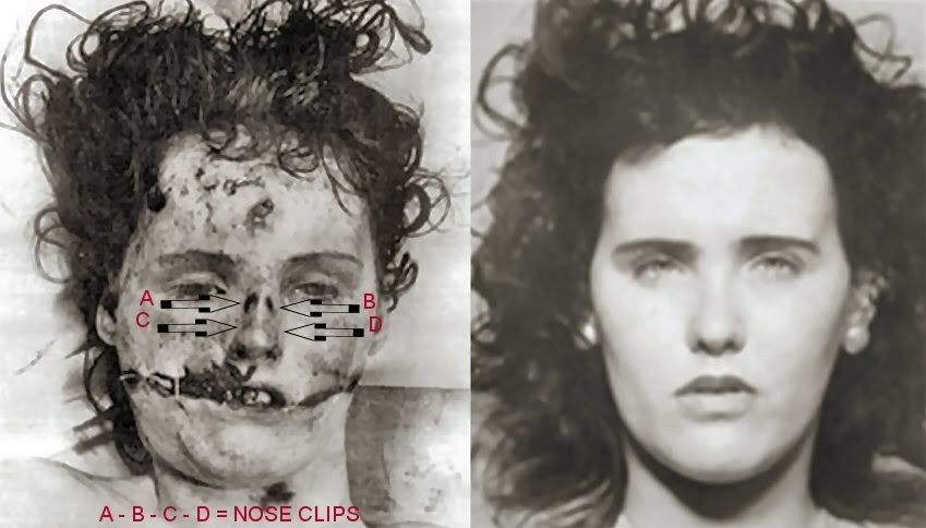 Elizabeth Short Post Mortem by Los Angeles Coroner