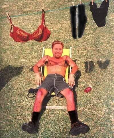 dantesunburn.jpg